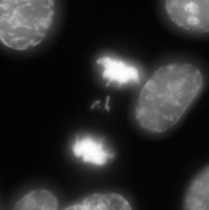 Anaphase lagging chromosome