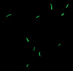 USE GFP microscopy cropped smaller